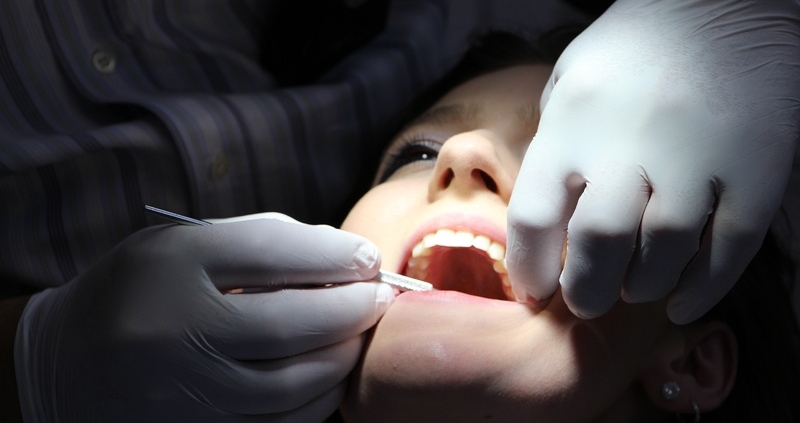Impianti dentali