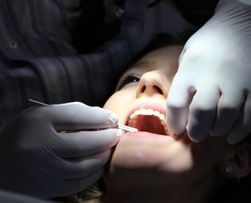 Impianti dentali